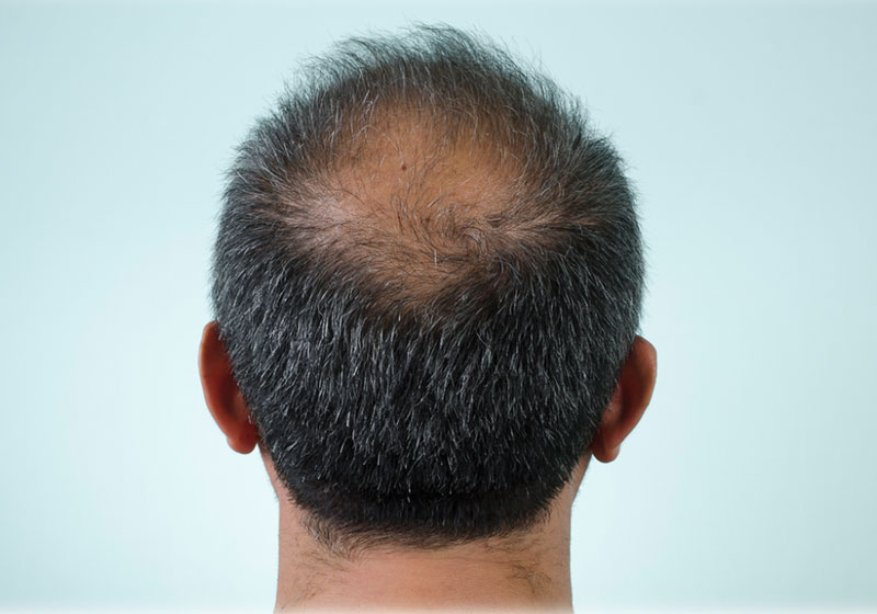 Foto: herkisi/iStock