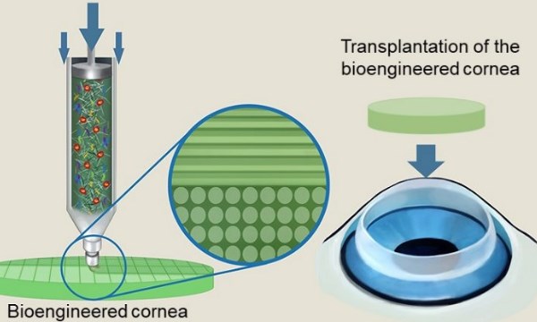 cornea2