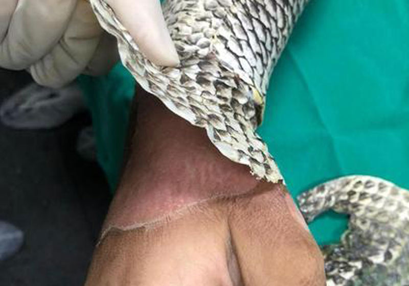 Pele de tilápia para queimados - Foto: divulgação
