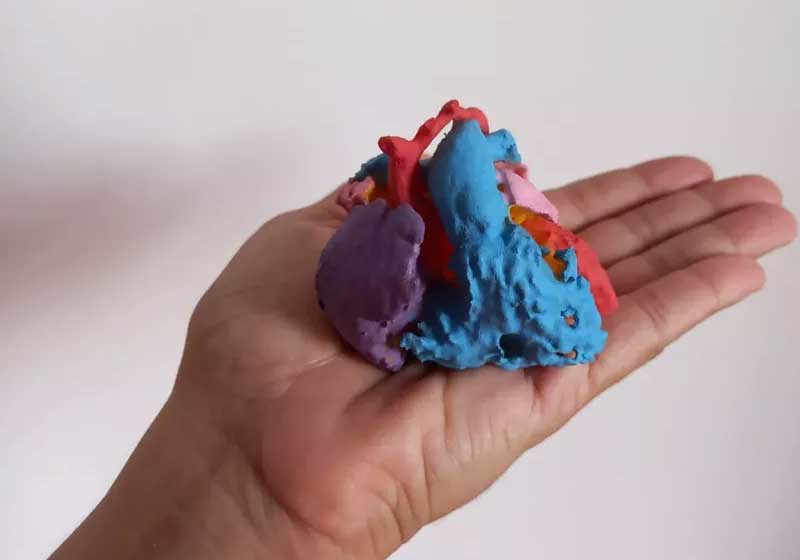 Médicos salvam a vida de bebê com coração impresso em 3D