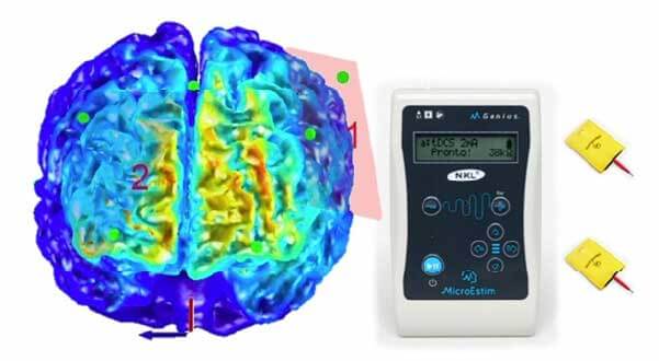 Os pontos 1 e 2 mostram onde os eletrodos são aplicados para o estudo - Foto: reprodução