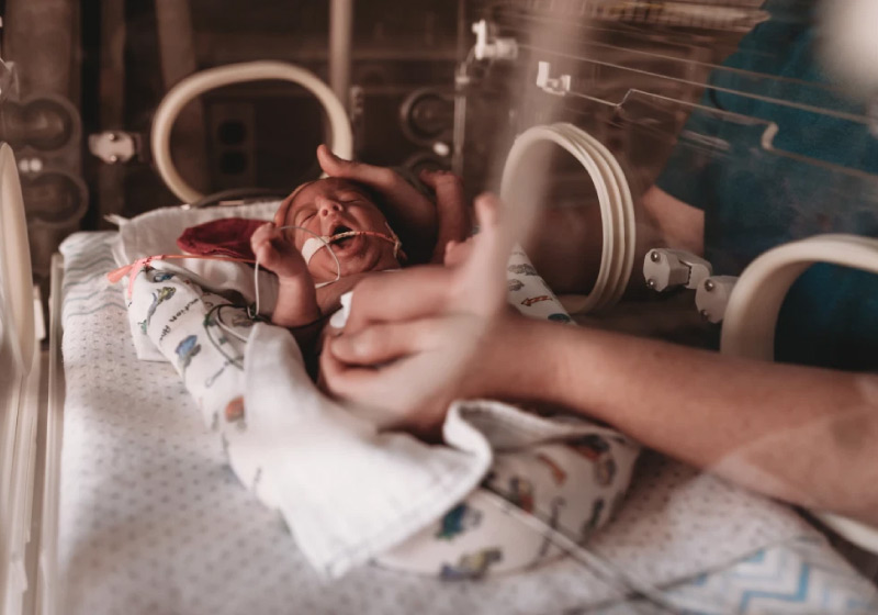 Dores de bebês prematuros melhoram com voz da mãe, diz estudo - Foto: Getty Images