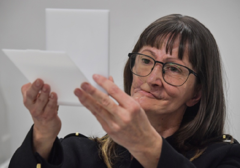 Denise Vicentin teve o rosto desfiguarado por tumores e é uma das pacientes atendidas pelo Instituto Mais Identidade - Foto: divulgação